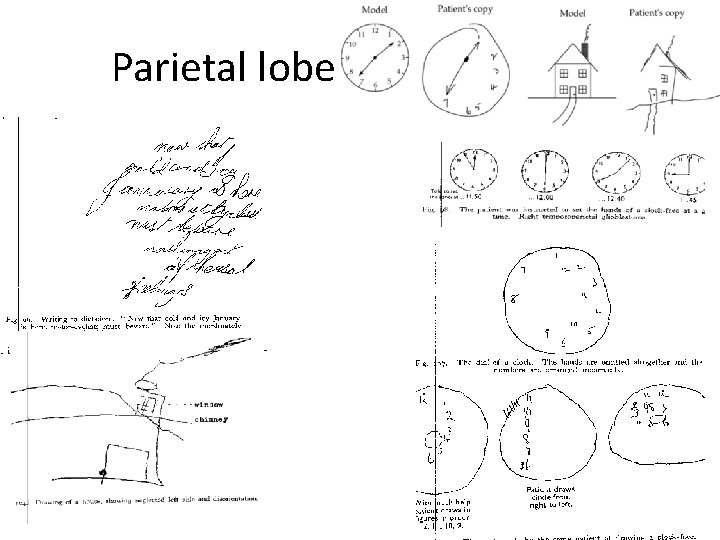 Parietal lobe 