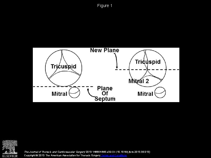 Figure 1 The Journal of Thoracic and Cardiovascular Surgery 2013 146854 -860. e 3