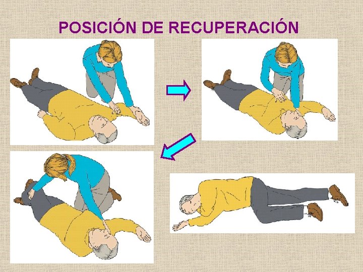 POSICIÓN DE RECUPERACIÓN 