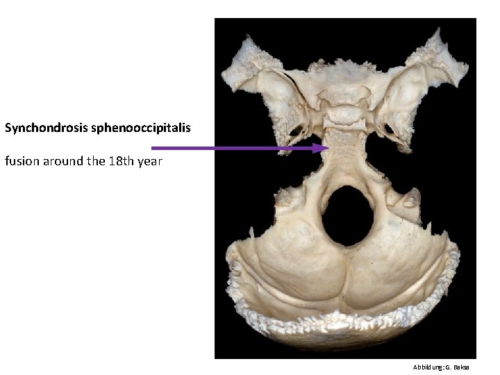 Synchondrosis sphenooccipitalis fusion around the 18 th year Abbildung: G. Baksa 