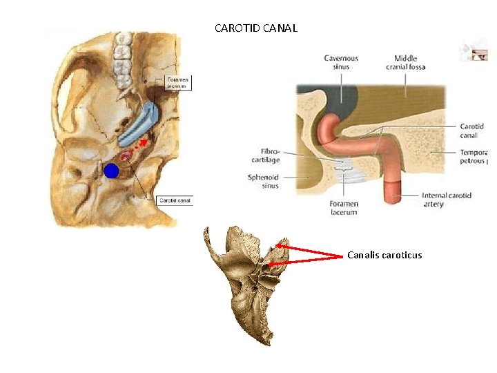 CAROTID CANAL Canalis caroticus 