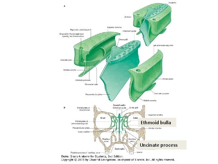 Ethmoid bulla Uncinate process 