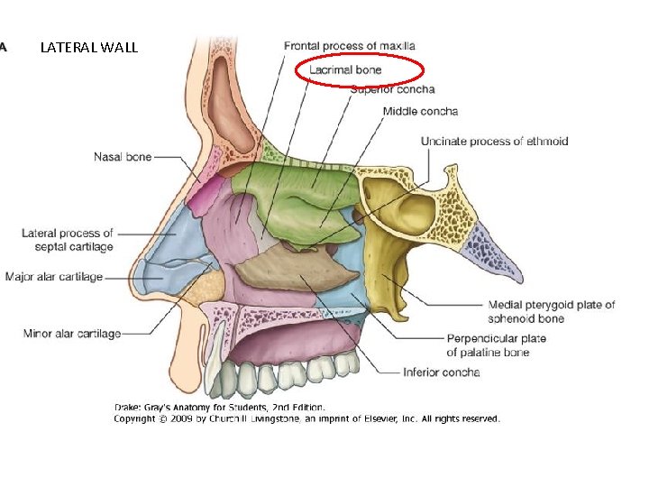 LATERAL WALL 