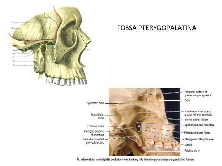 FOSSA PTERYGOPALATINA 