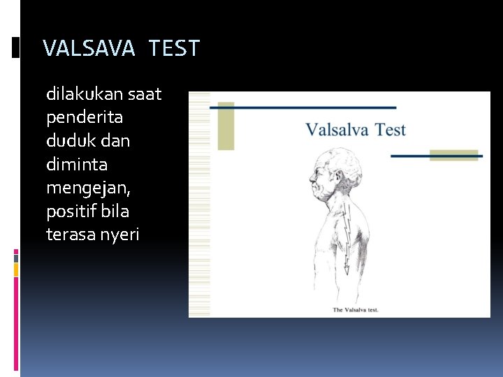 VALSAVA TEST dilakukan saat penderita duduk dan diminta mengejan, positif bila terasa nyeri 