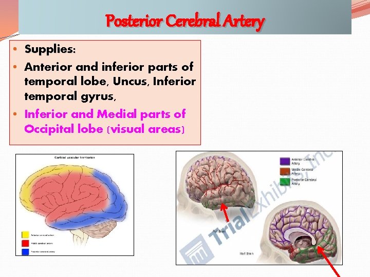 Posterior Cerebral Artery • Supplies: • Anterior and inferior parts of temporal lobe, Uncus,