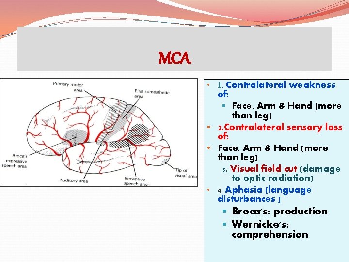 MCA • 1. Contralateral of: weakness § Face, Arm & Hand (more than leg)