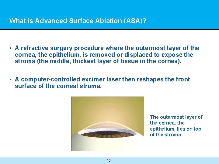 What is Advanced Surface Ablation (ASA)? • A refractive surgery procedure where the outermost
