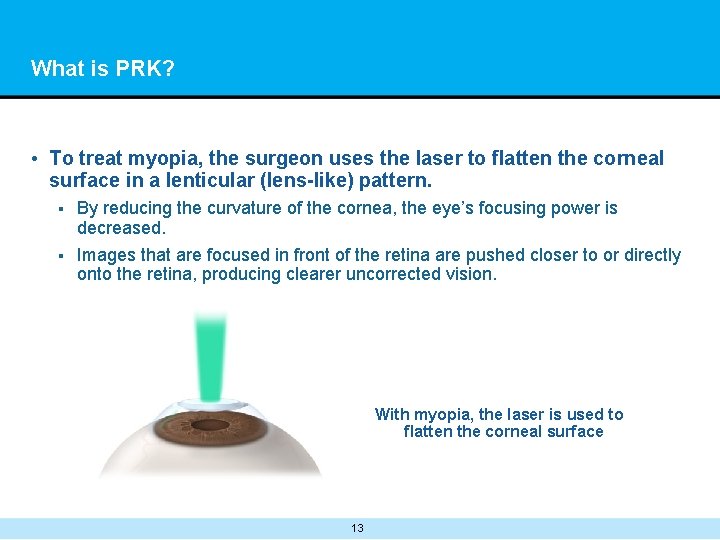 What is PRK? • To treat myopia, the surgeon uses the laser to flatten