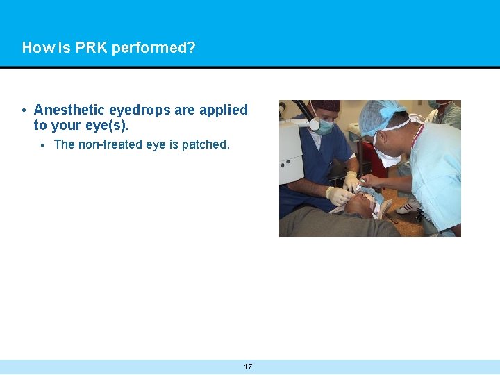 How is PRK performed? • Anesthetic eyedrops are applied to your eye(s). § The