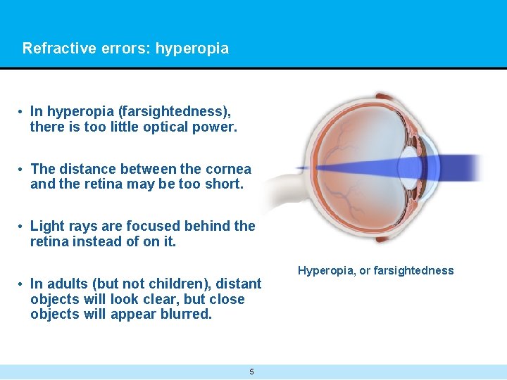 Refractive errors: hyperopia • In hyperopia (farsightedness), there is too little optical power. •