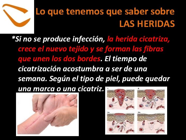 Lo que tenemos que saber sobre LAS HERIDAS *Si no se produce infección, la