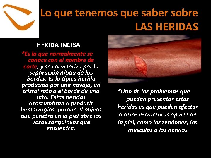 Lo que tenemos que saber sobre LAS HERIDA INCISA *Es lo que normalmente se