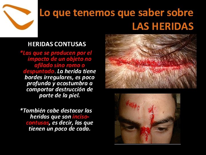 Lo que tenemos que saber sobre LAS HERIDAS CONTUSAS *Las que se producen por