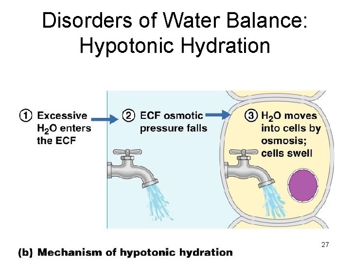 Disorders of Water Balance: Hypotonic Hydration 27 Figure 26. 7 b 