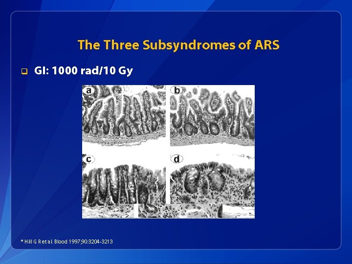 The Three Subsyndromes of ARS q GI: 1000 rad/10 Gy * Hill G R
