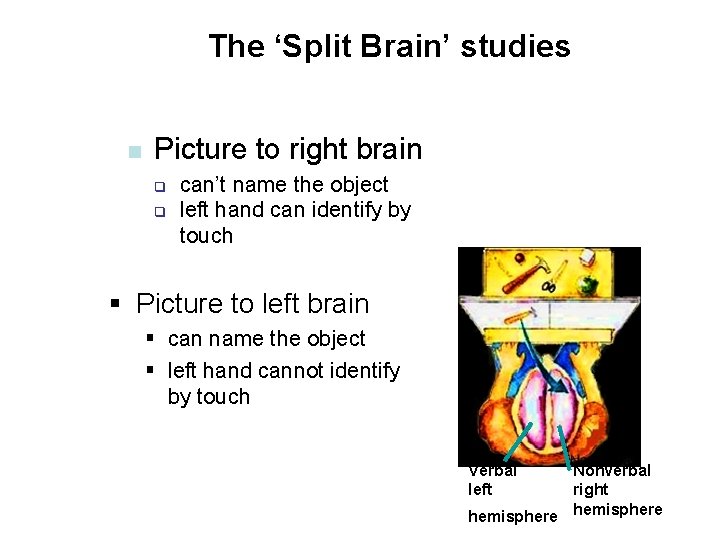 The ‘Split Brain’ studies n Picture to right brain q q can’t name the