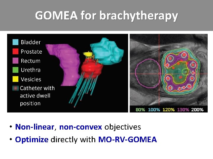GOMEA for brachytherapy • Non-linear, . non-convex. objectives • Optimize directly. with. MO-RV-GOMEA 