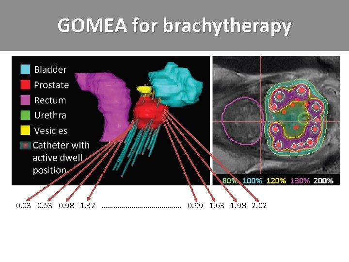 GOMEA for brachytherapy 0. 03 0. 53 0. 98 1. 32 …………………. 0. 99