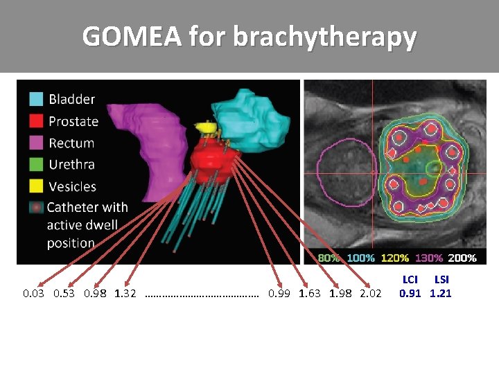 GOMEA for brachytherapy 0. 03 0. 53 0. 98 1. 32 …………………. 0. 99