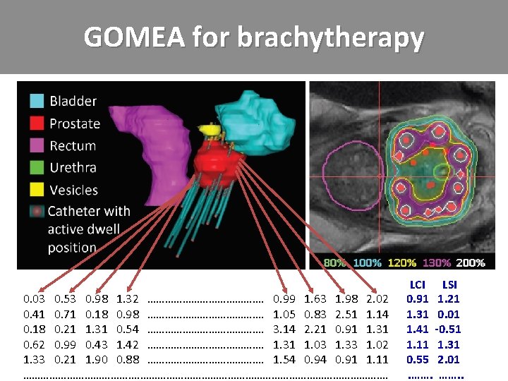GOMEA for brachytherapy 0. 03 0. 53 0. 98 1. 32 …………………. 0. 99