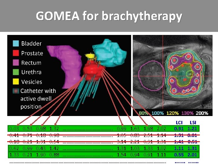 GOMEA for brachytherapy 0. 03 0. 53 0. 98 1. 32 …………………. 0. 99