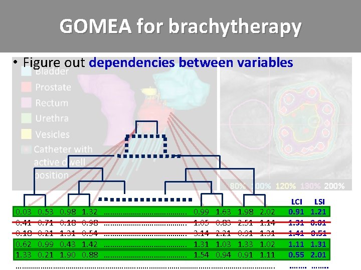 GOMEA for brachytherapy • Figure out dependencies between variables 0. 03 0. 53 0.