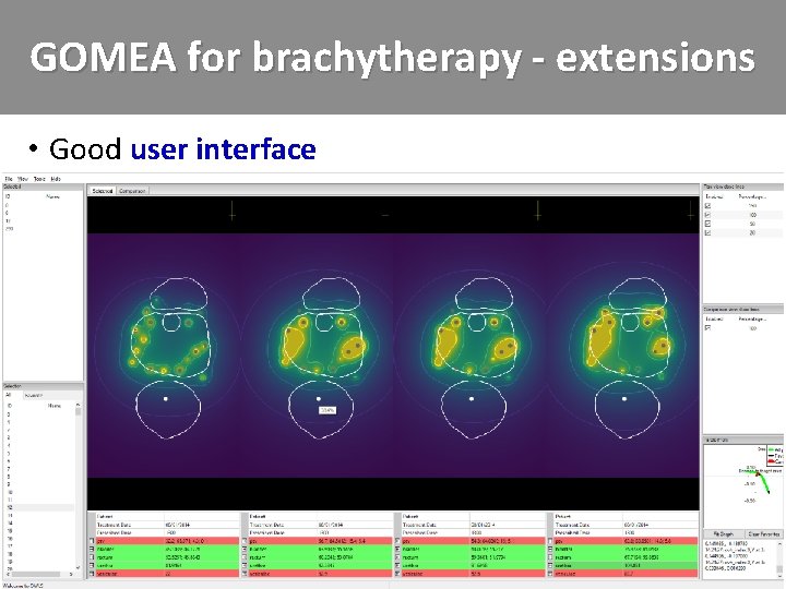 GOMEA for brachytherapy - extensions • Good user interface 
