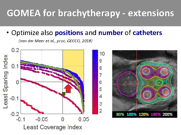 GOMEA for brachytherapy - extensions • Optimize also positions and number of catheters –