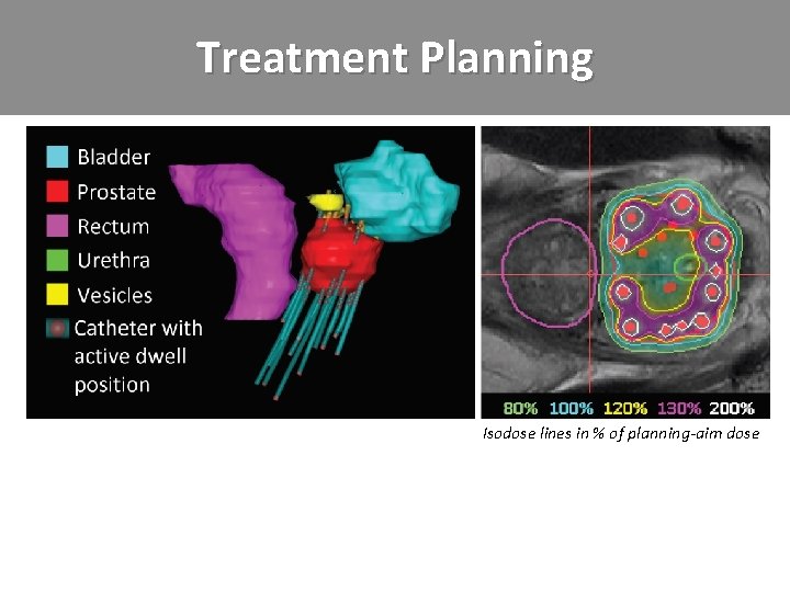 Treatment Planning Isodose lines in % of planning-aim dose 