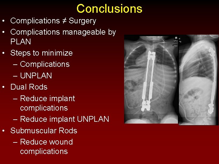 Conclusions • Complications ≠ Surgery • Complications manageable by PLAN • Steps to minimize