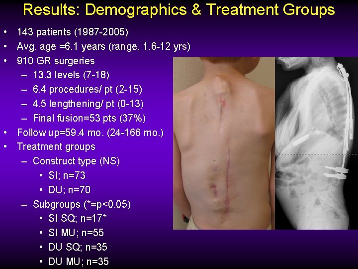 Results: Demographics & Treatment Groups • 143 patients (1987 -2005) • Avg. age =6.
