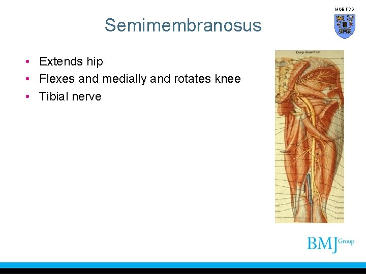 MOB TCD Semimembranosus • Extends hip • Flexes and medially and rotates knee •