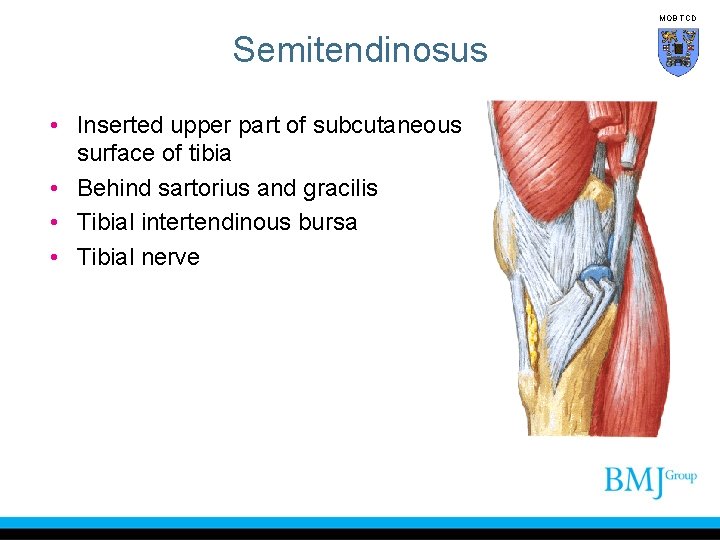 MOB TCD Semitendinosus • Inserted upper part of subcutaneous surface of tibia • Behind