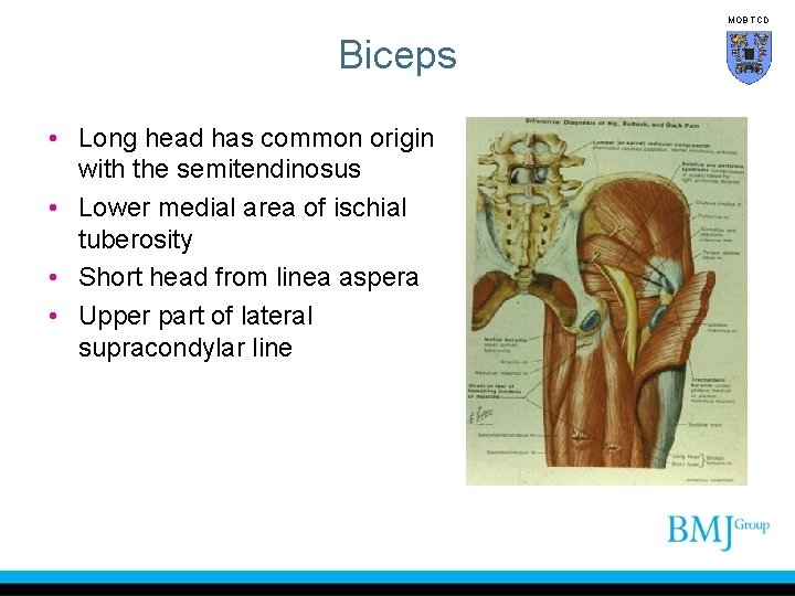MOB TCD Biceps • Long head has common origin with the semitendinosus • Lower