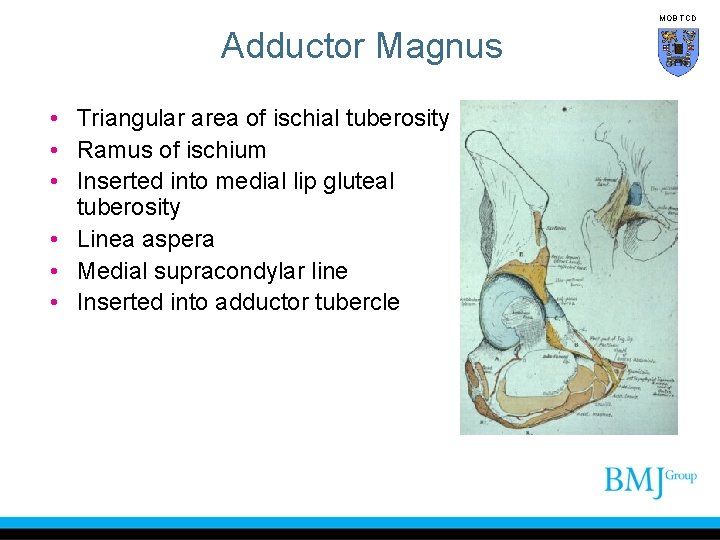 MOB TCD Adductor Magnus • Triangular area of ischial tuberosity • Ramus of ischium