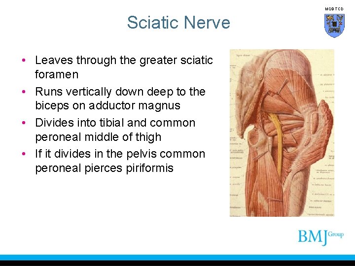 MOB TCD Sciatic Nerve • Leaves through the greater sciatic foramen • Runs vertically