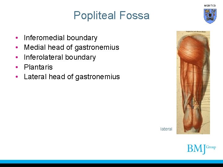 MOB TCD Popliteal Fossa • • • Inferomedial boundary Medial head of gastronemius Inferolateral