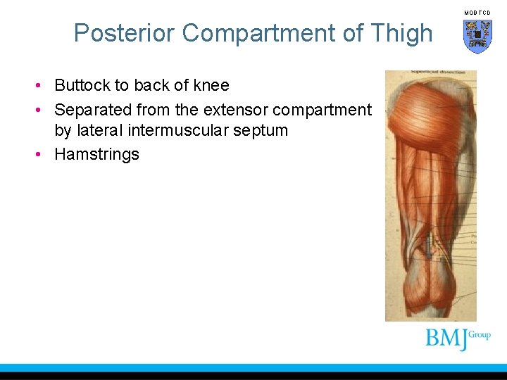 MOB TCD Posterior Compartment of Thigh • Buttock to back of knee • Separated