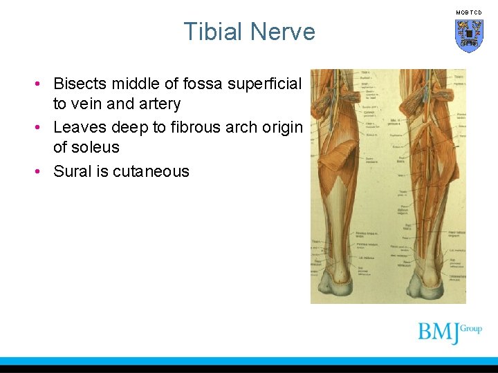 MOB TCD Tibial Nerve • Bisects middle of fossa superficial to vein and artery