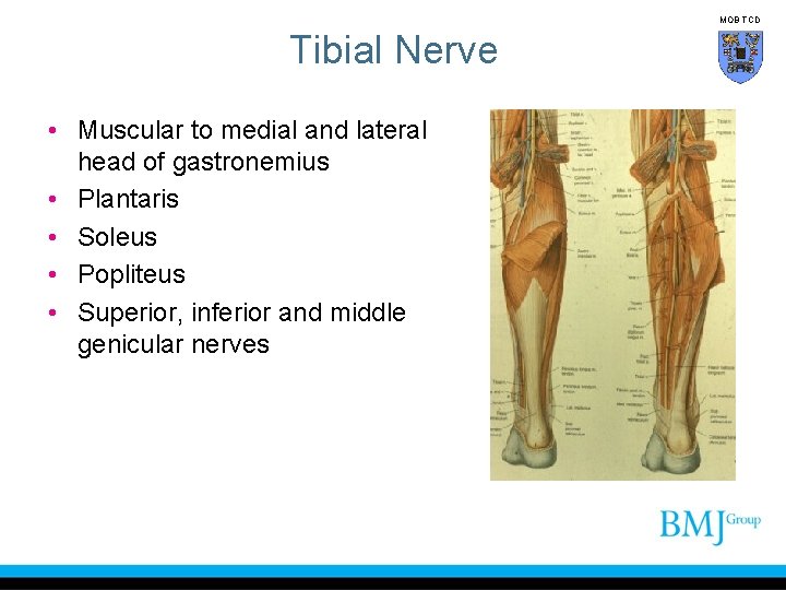 MOB TCD Tibial Nerve • Muscular to medial and lateral head of gastronemius •