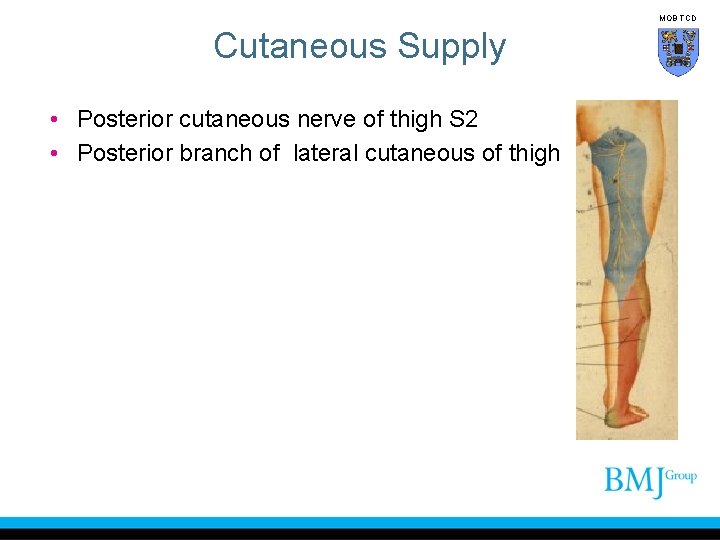 MOB TCD Cutaneous Supply • Posterior cutaneous nerve of thigh S 2 • Posterior