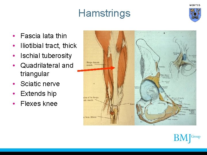 MOB TCD Hamstrings • • Fascia lata thin Iliotibial tract, thick Ischial tuberosity Quadrilateral