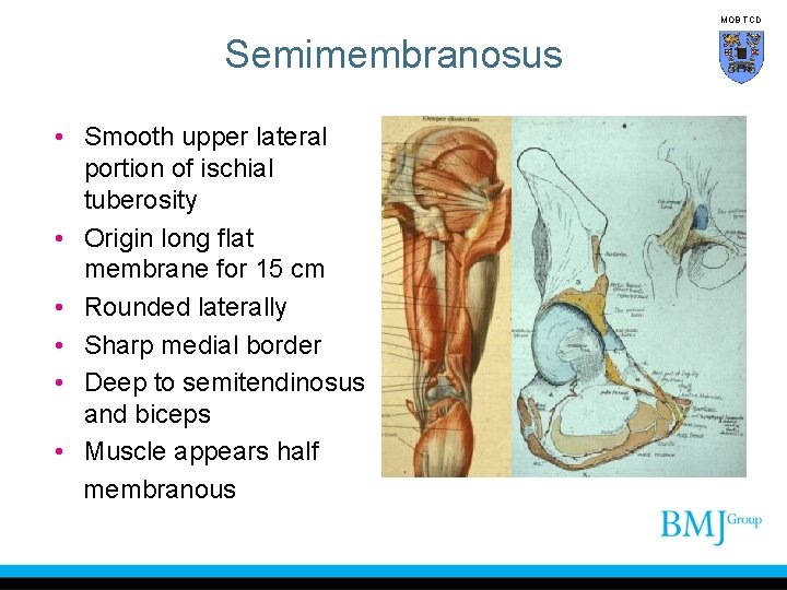 MOB TCD Semimembranosus • Smooth upper lateral portion of ischial tuberosity • Origin long