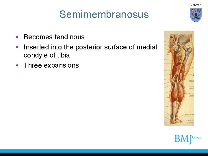 MOB TCD Semimembranosus • Becomes tendinous • Inserted into the posterior surface of medial