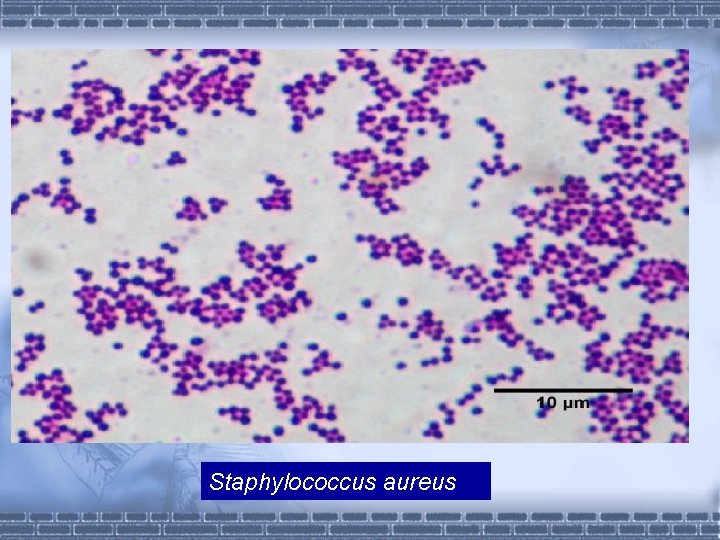 Staphylococcus aureus 