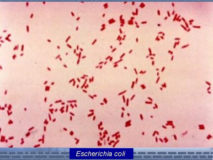 Escherichia coli 