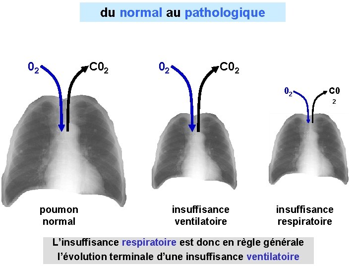 du normal au pathologique 02 C 02 02 C 0 2 poumon normal insuffisance