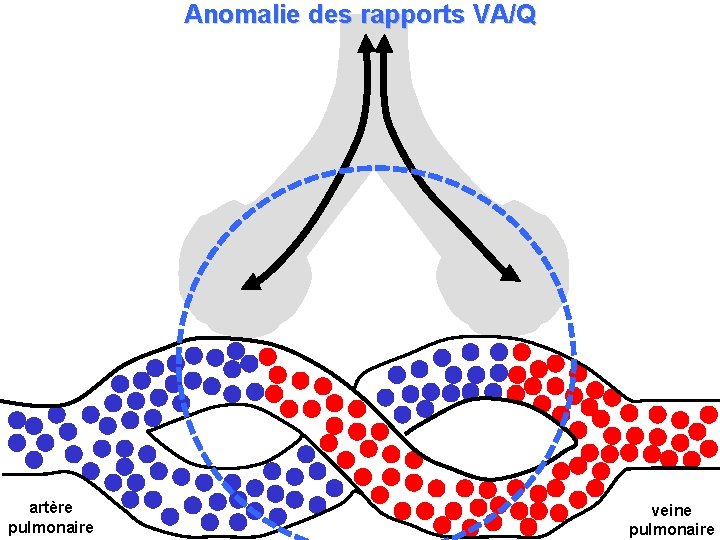 Anomalie des rapports VA/Q artère pulmonaire veine pulmonaire 