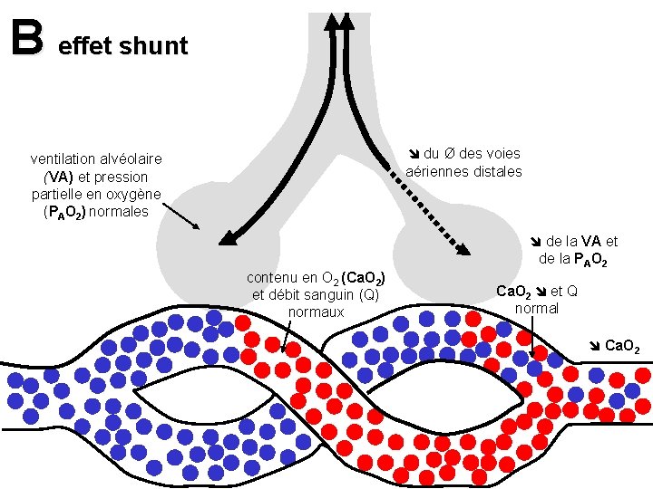 B effet shunt du Ø des voies aériennes distales ventilation alvéolaire (VA) et pression